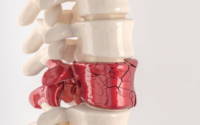 Contraindicaciones de la quiropráctica