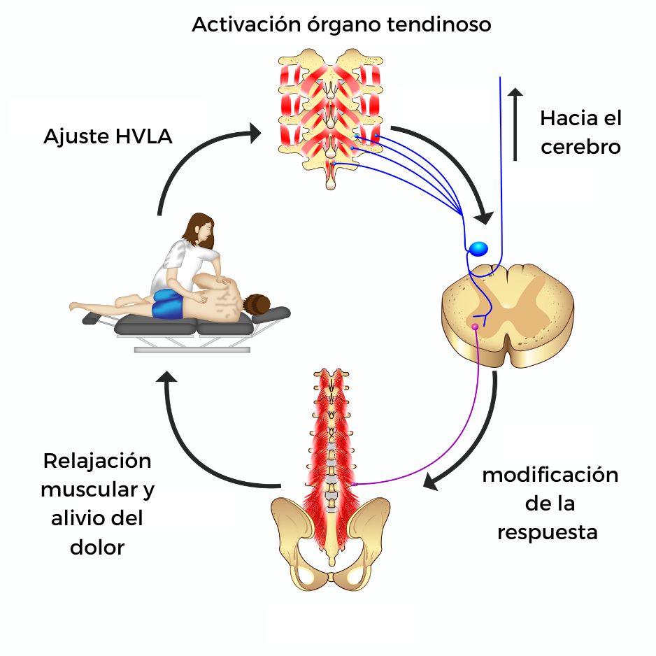 Técnica HVLA
